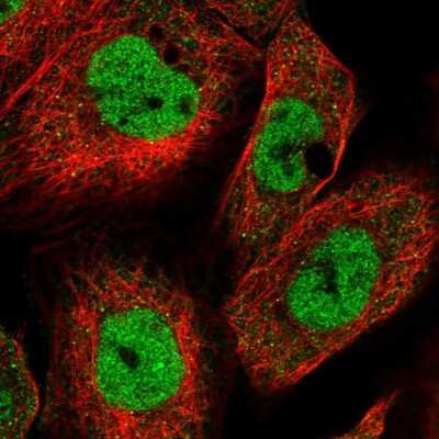 Immunocytochemistry/ Immunofluorescence: KMT2A/MLL Antibody [NBP2-55237]