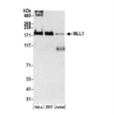 Western Blot: KMT2A/MLL Antibody [NB600-256]