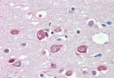 Immunohistochemistry-Paraffin: KMT2B Antibody [NB300-864]