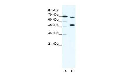 Western Blot: KMT2B Antibody [NBP2-82270]