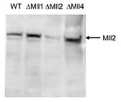 Western Blot: KMT2B Antibody [NBP3-18667]