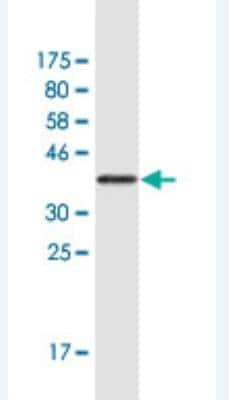 Western Blot: KMT2D Antibody (2E1) [H00008085-M01]