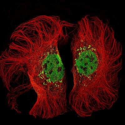 Immunocytochemistry/ Immunofluorescence: KMT2D Antibody (CL5346) [NBP2-61416]