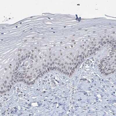 Immunohistochemistry-Paraffin: KMT2D Antibody [NBP1-89123]