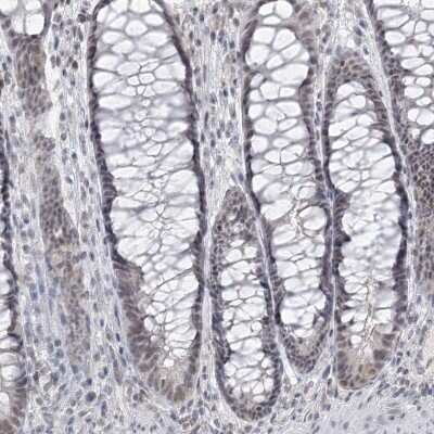 Immunohistochemistry-Paraffin: KMT2D Antibody [NBP1-89123]