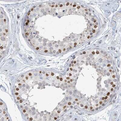 Immunohistochemistry-Paraffin: KMT2D Antibody [NBP1-89123]
