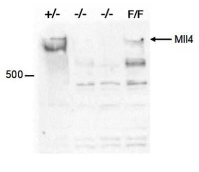 Western Blot: KMT2D Antibody [NBP3-18671]