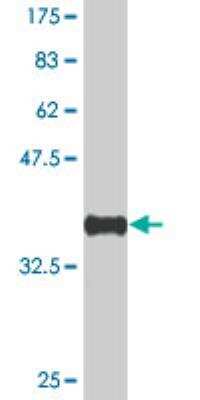 Western Blot: KMT3B/NSD1 Antibody (1C12) [H00064324-M05]