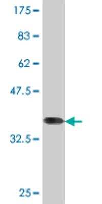 Western Blot: KMT3B/NSD1 Antibody (3E6) [H00064324-M06]