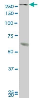 Western Blot: KMT3B/NSD1 Antibody (4F1) [H00064324-M08]