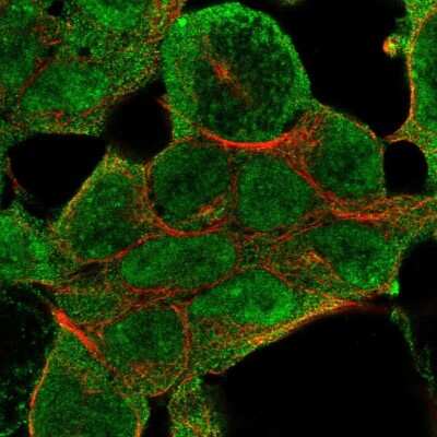 Immunocytochemistry/ Immunofluorescence: KMT3B/NSD1 Antibody [NBP2-56325]