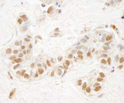 Immunohistochemistry-Paraffin: KMT3B/NSD1 Antibody [NB100-1744]