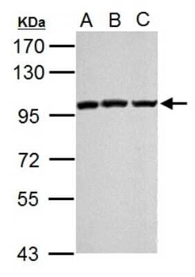 Western Blot: EZH2/KMT6 Antibody [NBP2-17087]