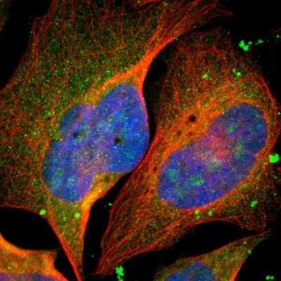 Immunocytochemistry/ Immunofluorescence: KNL-2 Antibody [NBP1-89905]