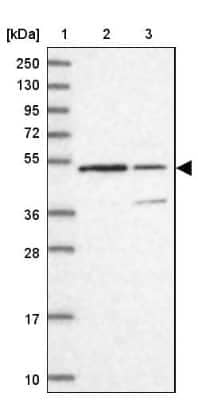 Western Blot: KNOP1 Antibody [NBP2-48730]