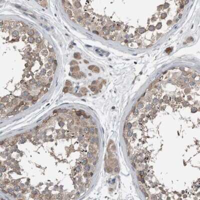 Immunohistochemistry-Paraffin: KNTC1 Antibody [NBP1-83032]