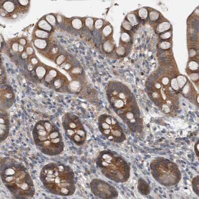Immunohistochemistry-Paraffin: KNTC1 Antibody [NBP1-83032]