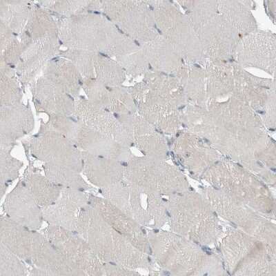 Immunohistochemistry-Paraffin: KNTC1 Antibody [NBP1-83032]