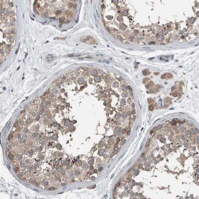 Immunohistochemistry-Paraffin: KNTC1 Antibody [NBP1-83032]