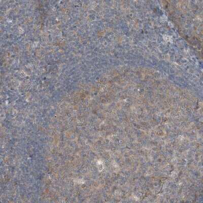 Immunohistochemistry-Paraffin: KNTC1 Antibody [NBP1-83032]