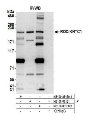 Immunoprecipitation: KNTC1 Antibody [NB100-88130]