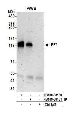 Immunoprecipitation: KNTC1 Antibody [NB100-88131]