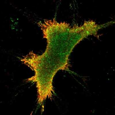 Immunocytochemistry/ Immunofluorescence: KOR Antibody [NBP2-68859]