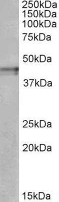 Western Blot: KOR Antibody [NBP1-68860]