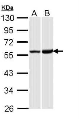 Western Blot: KOR Antibody [NBP2-17015]