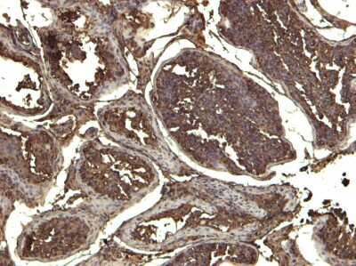 Immunohistochemistry-Paraffin: KPNA3 Antibody [NB100-1373]