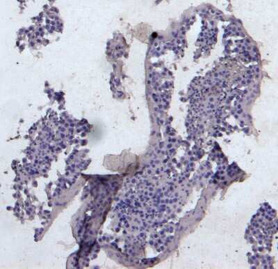 Immunohistochemistry-Paraffin: KPNA3 Antibody [NB100-1373]