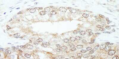 Immunohistochemistry-Paraffin: KPNA3 Antibody [NB100-81650]