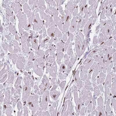 Immunohistochemistry-Paraffin: KPNA3 Antibody [NBP2-14172]