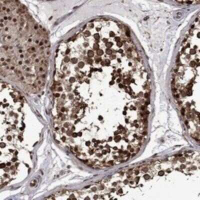 Immunohistochemistry-Paraffin: KPNA3 Antibody [NBP3-17268]