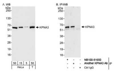 Western Blot: KPNA3 Antibody [NB100-81650]