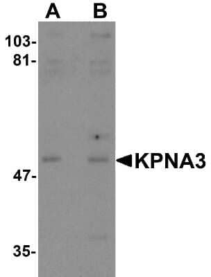 Western Blot: KPNA3 AntibodyBSA Free [NBP1-76299]