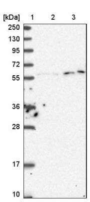 Western Blot: KPNA3 Antibody [NBP2-14172]