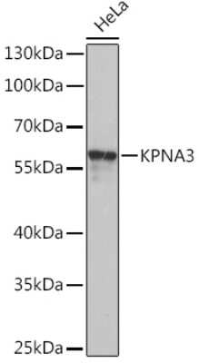 Western Blot: KPNA3 AntibodyBSA Free [NBP3-15498]