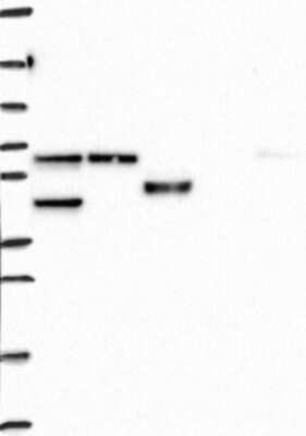 Western Blot: KPNA3 Antibody [NBP3-17268]