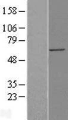 Western Blot: Importin alpha 3/KPNA4 Overexpression Lysate [NBL1-12372]