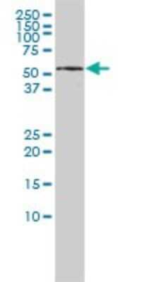 Western Blot: KPNA5 Antibody (1D2) [H00003841-M01]
