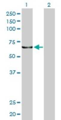 Western Blot: KPNA5 Antibody (1D2) [H00003841-M01]