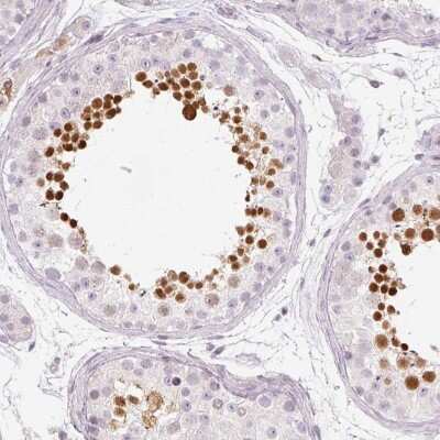 Immunohistochemistry-Paraffin: KPNA5 Antibody [NBP2-38715]
