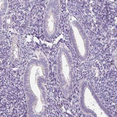 Immunohistochemistry-Paraffin: KPNA5 Antibody [NBP2-38715]