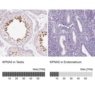 Immunohistochemistry-Paraffin: KPNA5 Antibody [NBP2-38715]