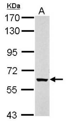 Western Blot: KPNA5 Antibody [NBP2-17089]