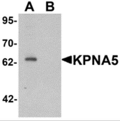 Western Blot: KPNA5 AntibodyBSA Free [NBP2-81835]