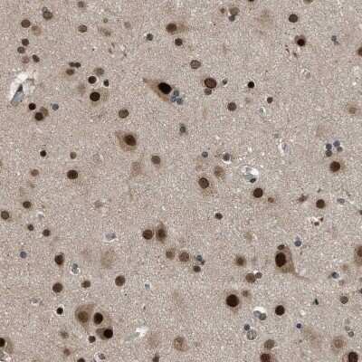 Immunohistochemistry-Paraffin: KPNA6 Antibody [NBP1-83762]