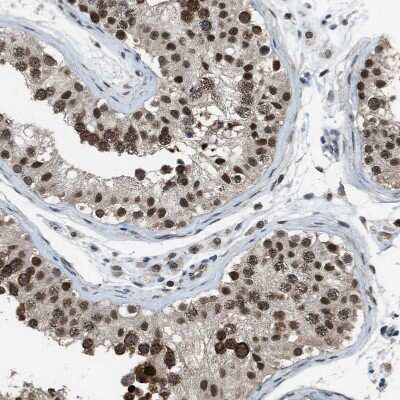 Immunohistochemistry-Paraffin: KPNA6 Antibody [NBP1-83762]