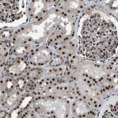 Immunohistochemistry-Paraffin: KPNA6 Antibody [NBP1-83762]